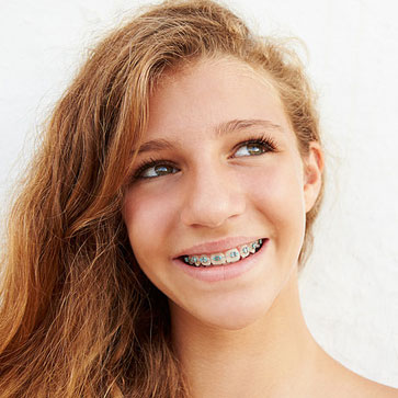 Traditional Braces Atlanta, GA, Self-Ligating Orthodontics